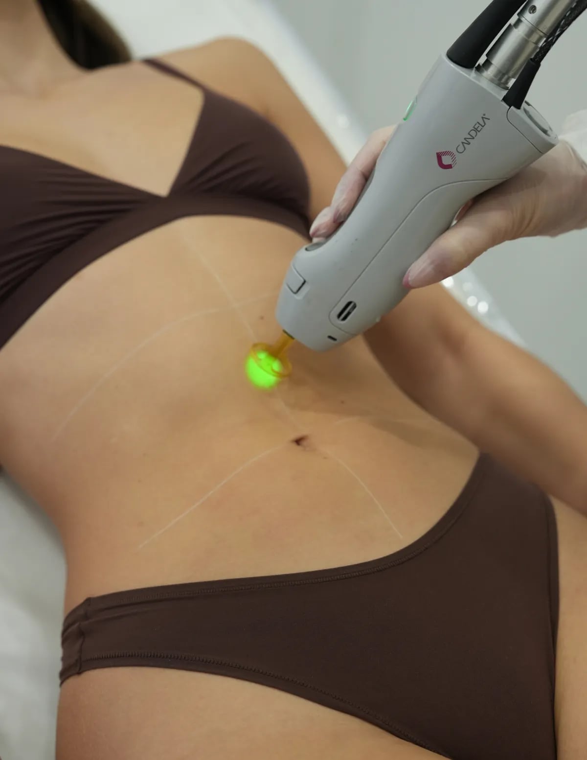 A Semper client with smooth skin after laser hair removal